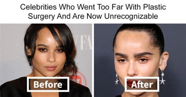 Uncovering The Truth Behind The Plastic Surgery Rumors