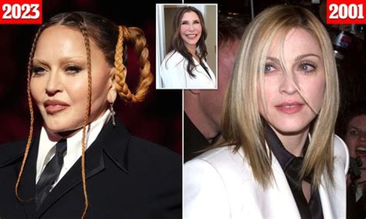 Unveiling Lexi Rivera's Plastic Surgery: Discoveries And Insights